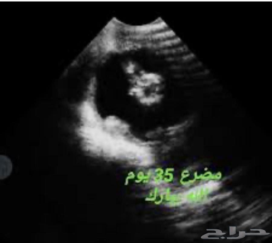 Sheep ultrasound examination only63264804837377112