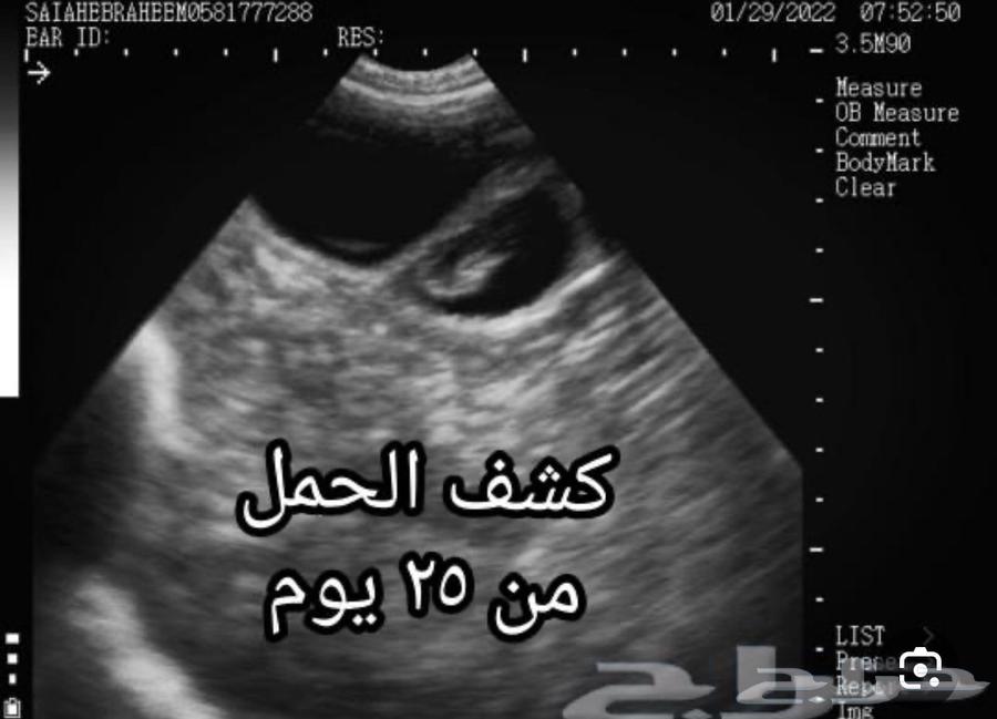 Sheep ultrasound examination only63264804837377111