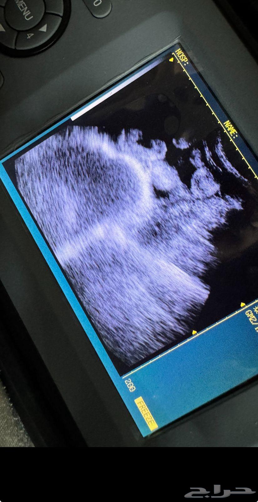 Sheep ultrasound examination only63264804837377113