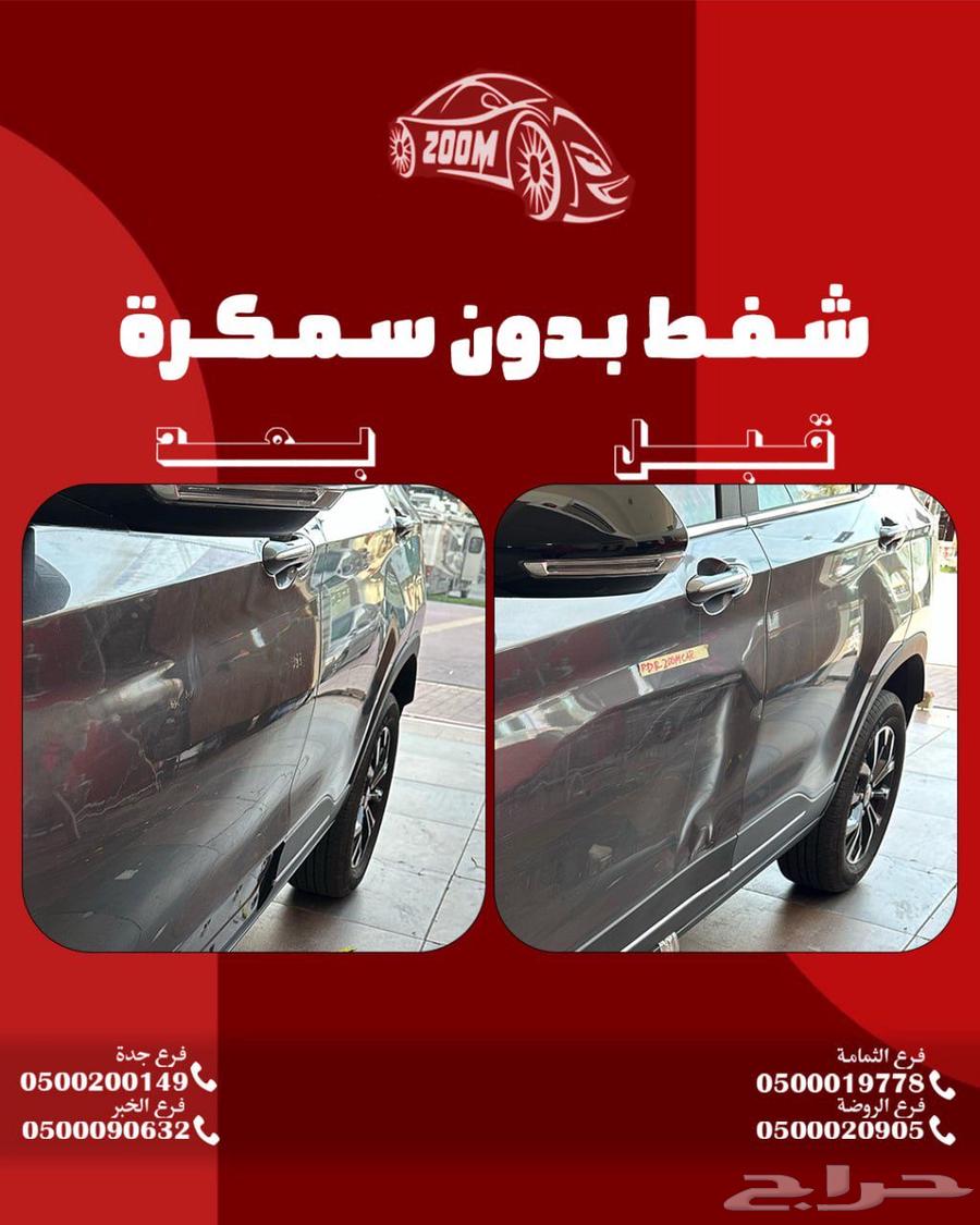 شفط الطعجات63353427355009113
