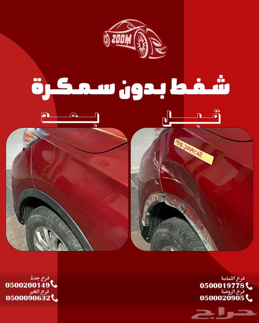 شفط الطعجات63353427355009112