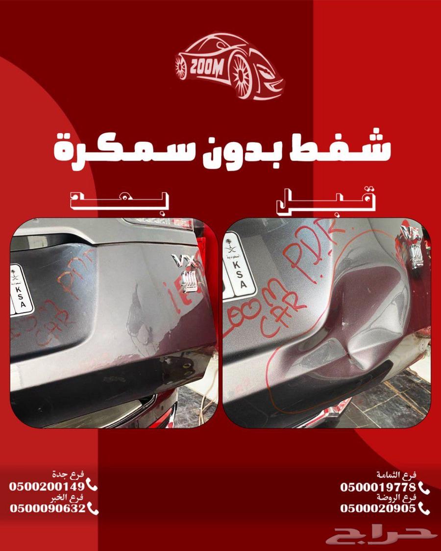 شفط الطعجات63353427355009111