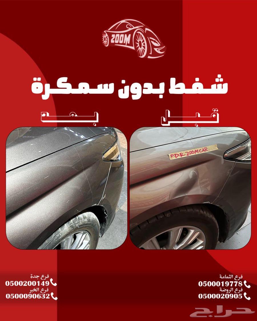 شفط الطعجات63353427355009114