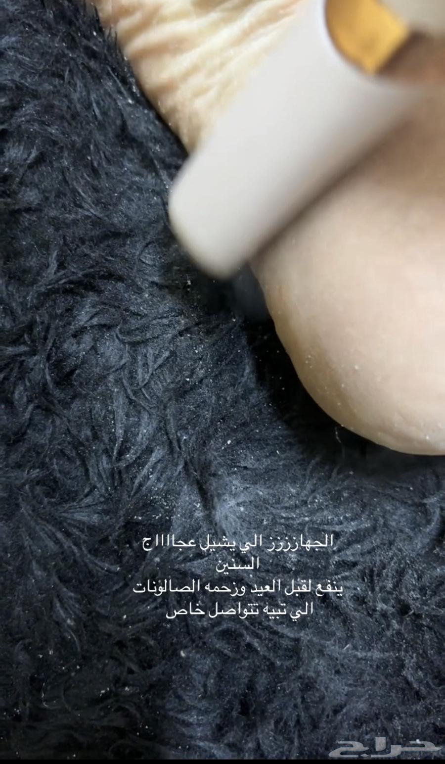 جهاز تقشير للقدم63161763206401114
