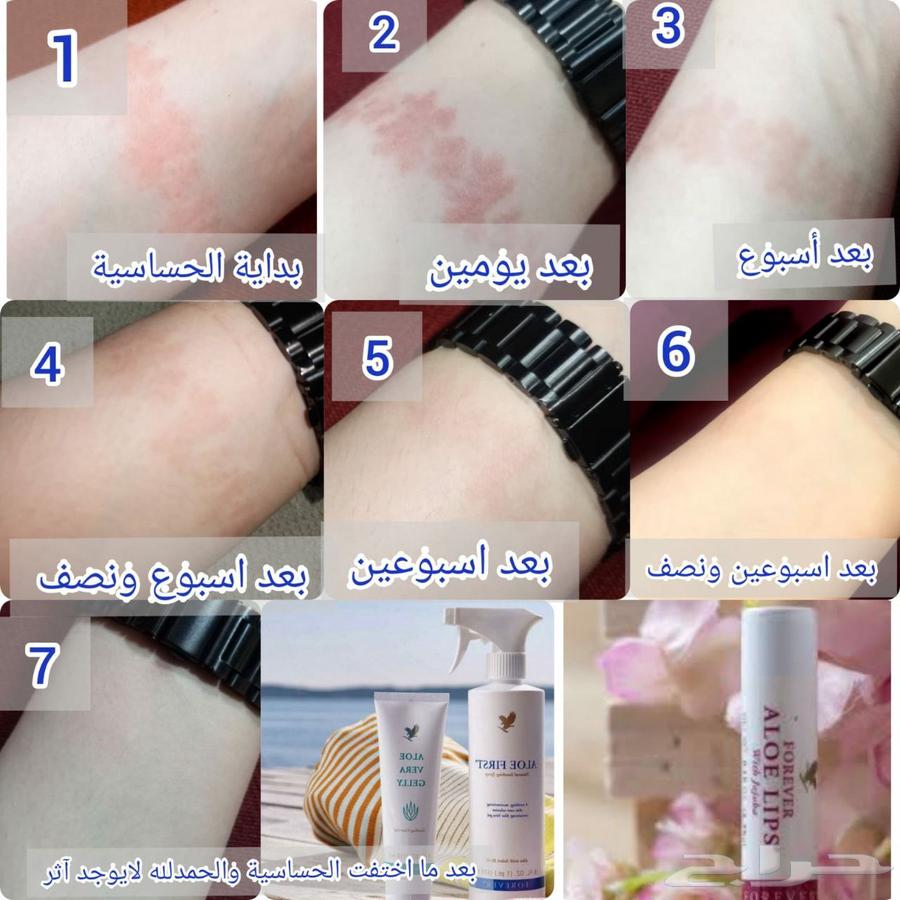 البيع الاكزيما63391366929666112