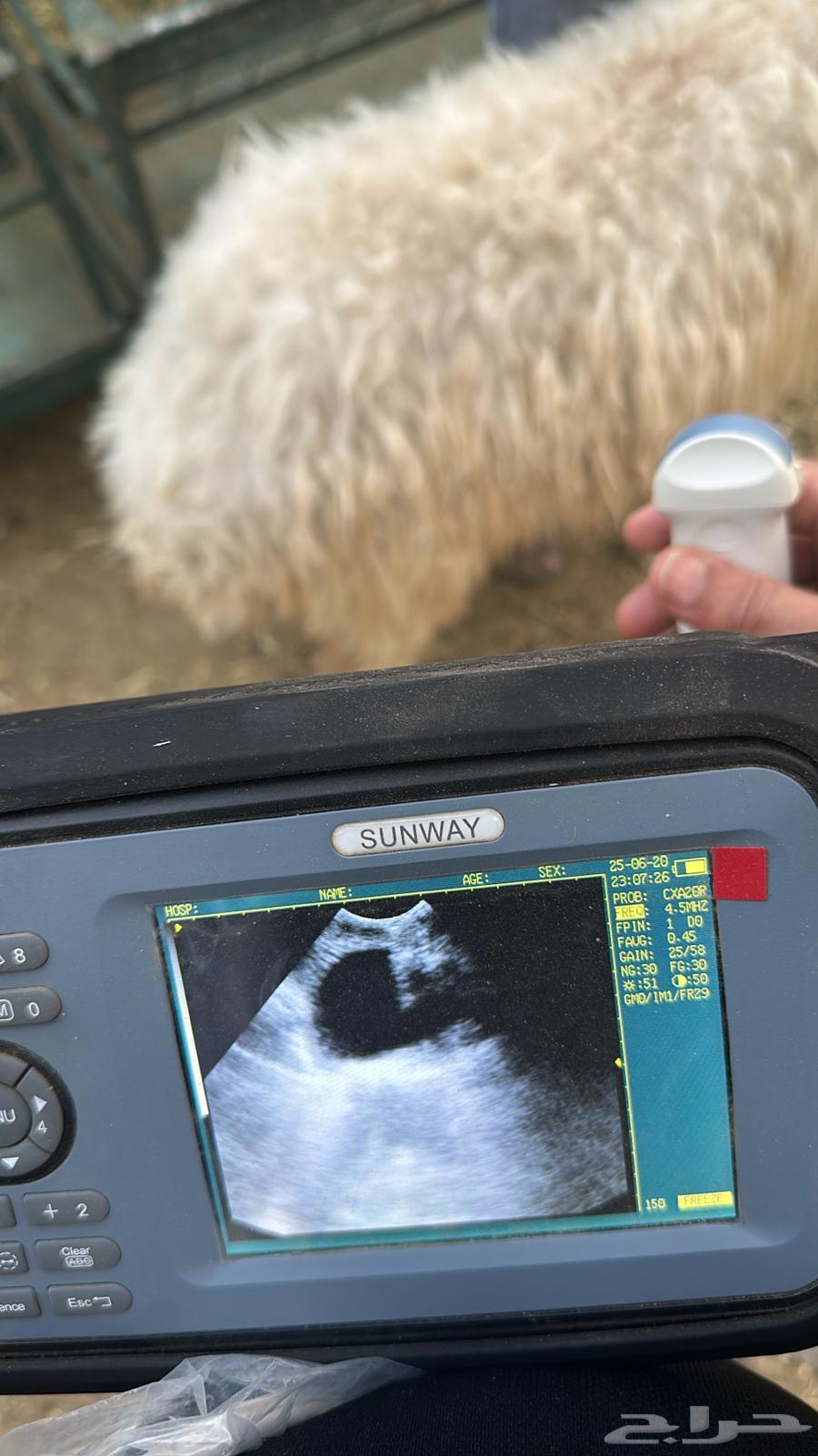 Ultrasound examination in the Eastern Province by quantity63618676543618112