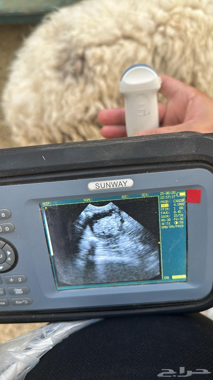 Ultrasound examination in the Eastern Province by quantity63618676543618113