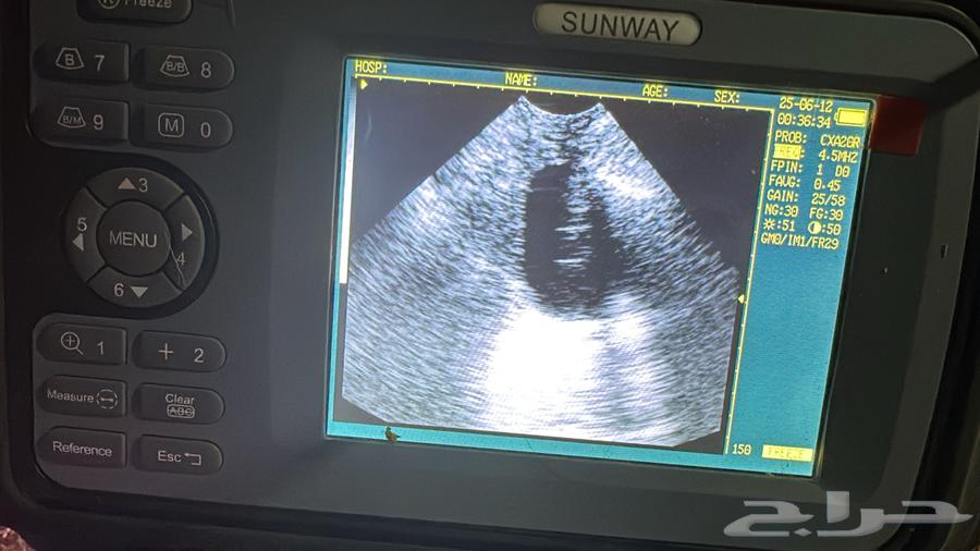 Ultrasound examination in the Eastern Province by quantity63618676543618114