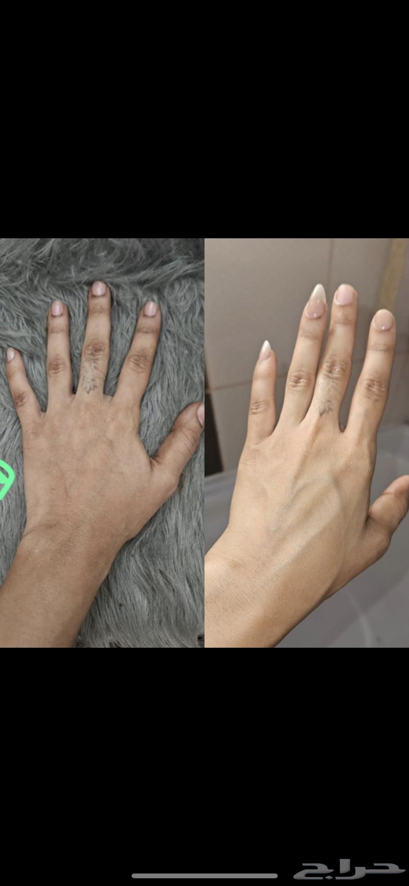 كريم تبييض63670266347138112
