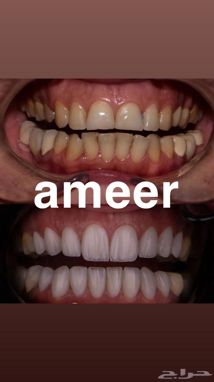 عيادة اسنان بالخبر63705944153987114