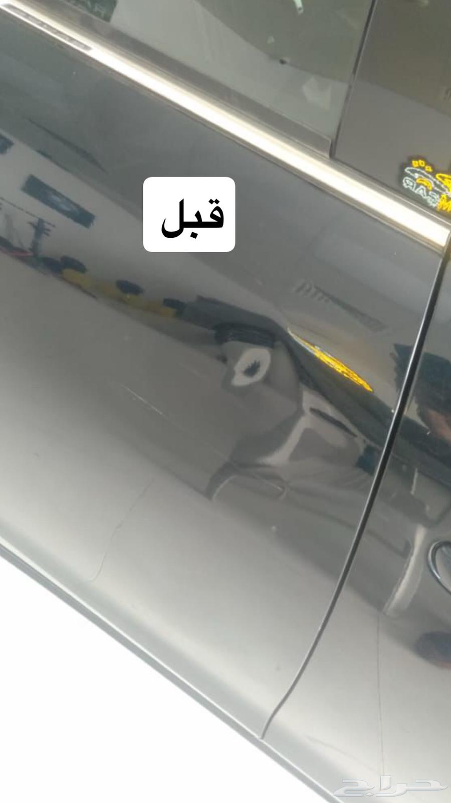 شفط الصدمات والضربات با احدث أجهزه التقنية64385369863427111