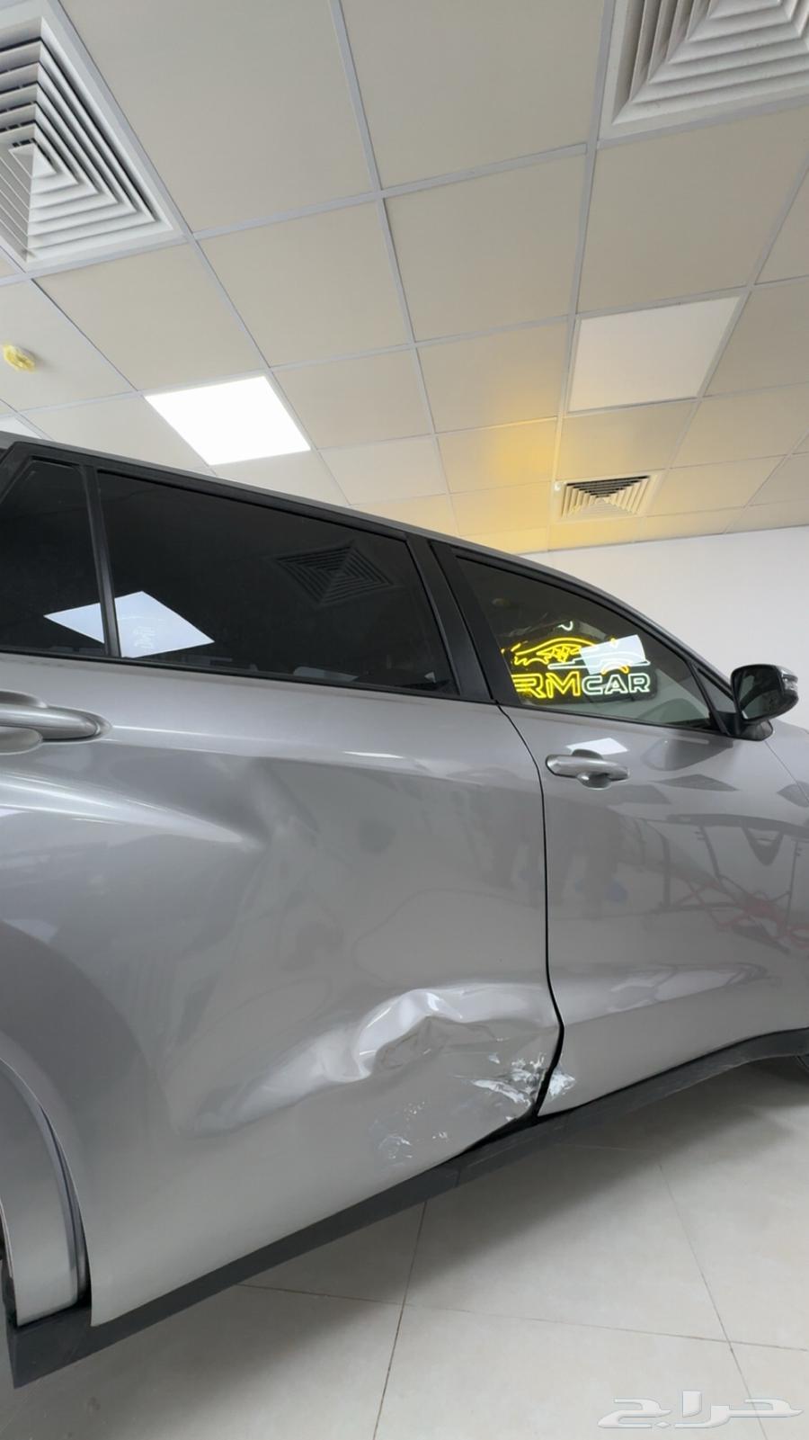 شفط الصدمات والضربات با احدث أجهزه التقنية64385369863427112