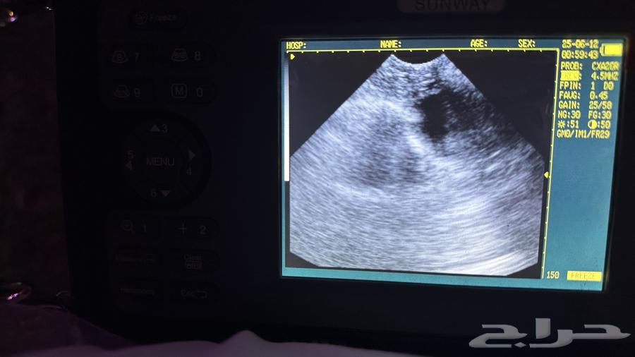 فحص سونار للحيوانات64190368040193111