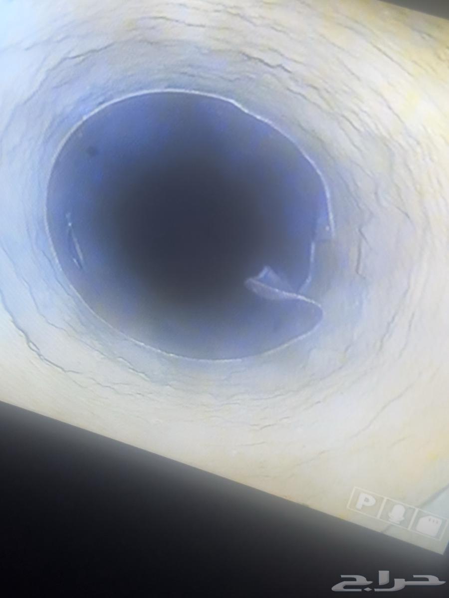 Pipeline inspection and fault detection64257224909441111