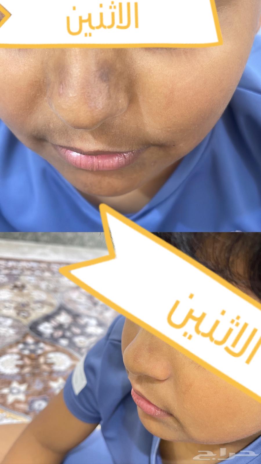 كريم تبييض البشره وازالة التصبغات64356048475521114