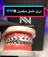 تقويم اسنان زينه عروض اليوم الوطني64375052450945110