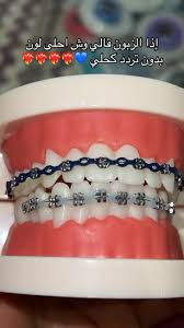 تقويم اسنان زينه عروض اليوم الوطني64375052450945111