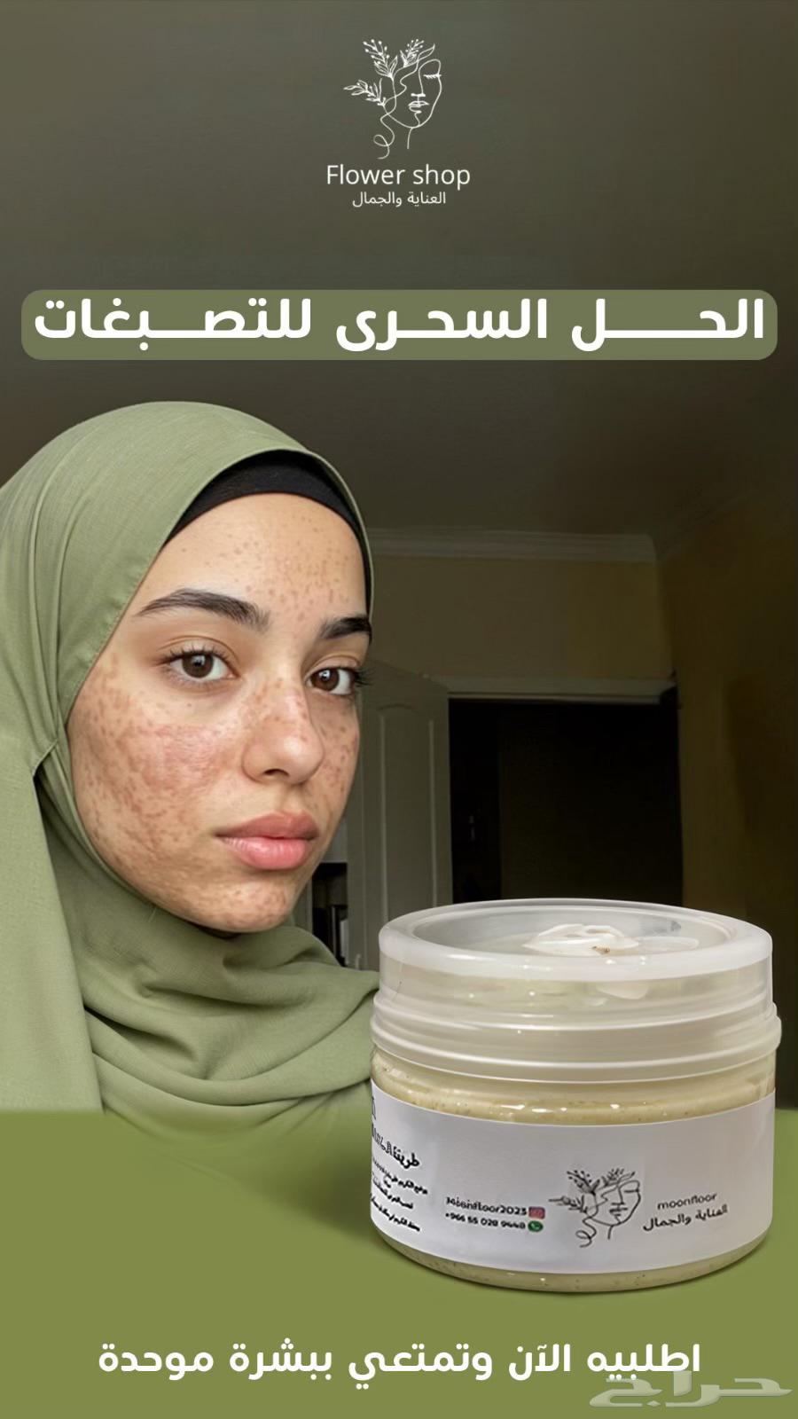 كريم تبييض البشره وازالة التصبغات64366615192067110