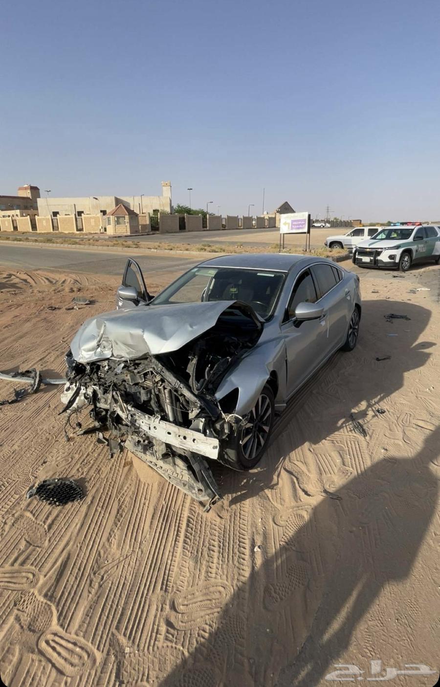 The left side of the face was severely injured and hit the steering wheel before the car stopped.63618148870659113