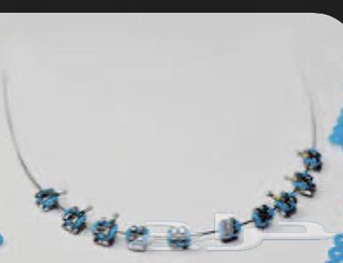 تقويم أسنان64411808549121112