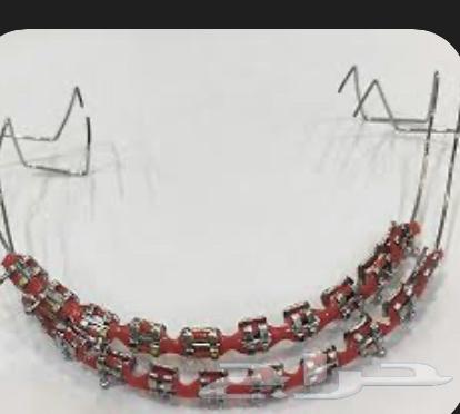 تقويم أسنان64411808549121110