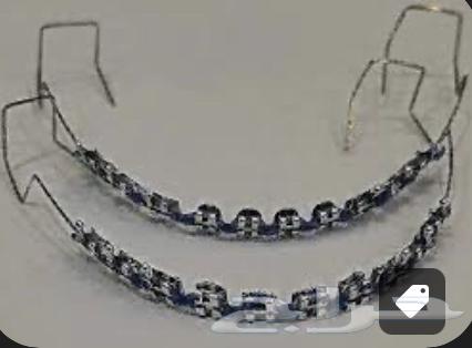 تقويم أسنان64411808549121114