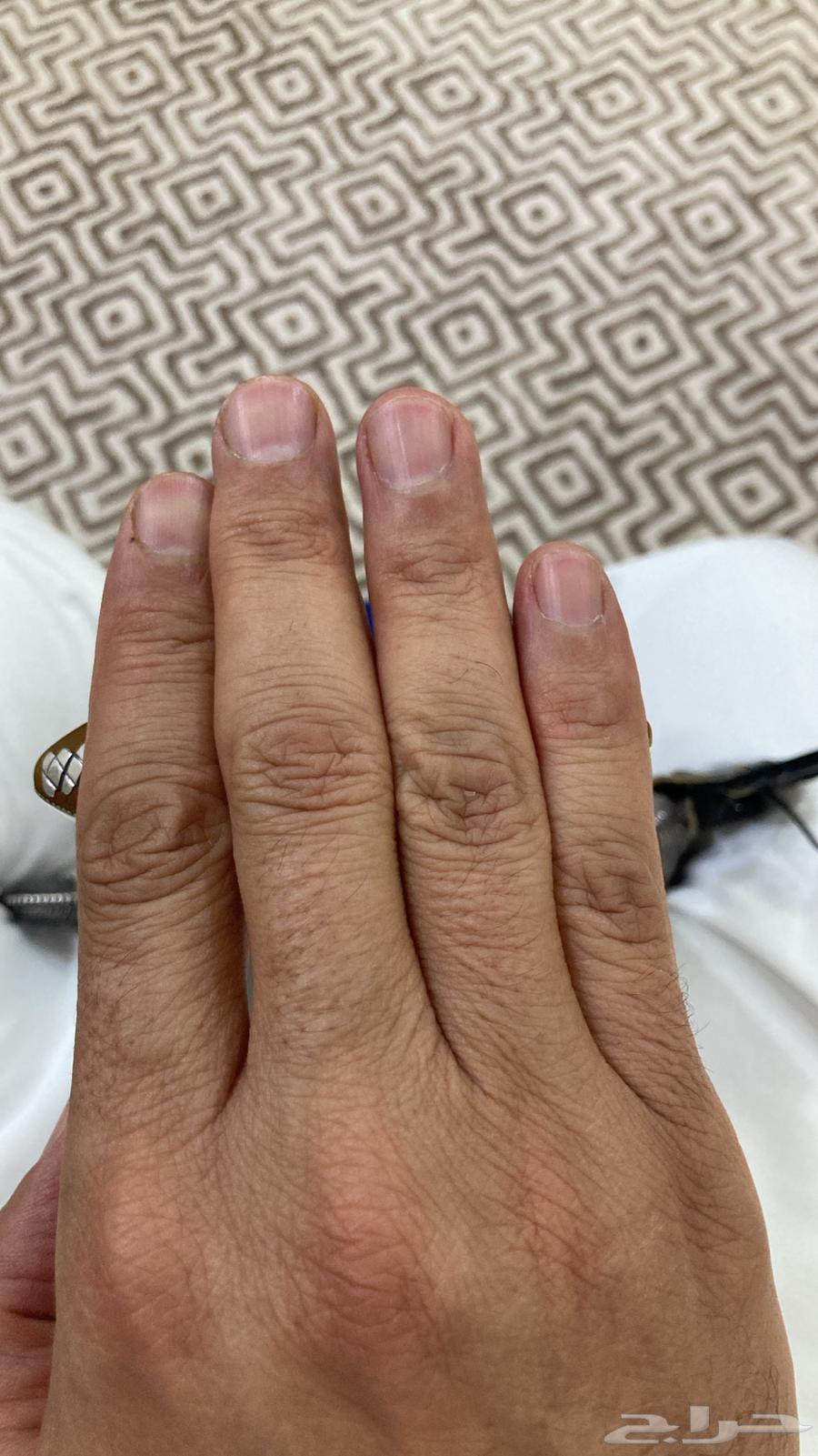 جنبيه زراف64487456815874112