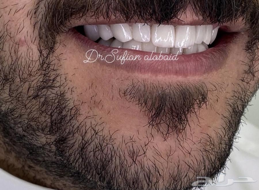 عروض ابتسامة هوليوود بمناسبة اليوم الوطني64529348523651111