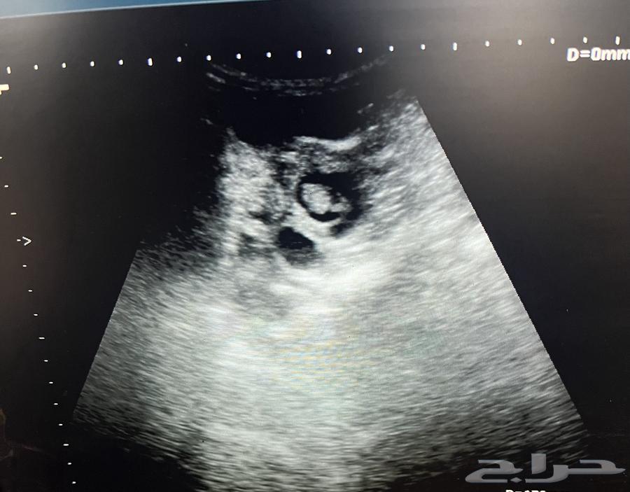 Sonar examination64542500913794110