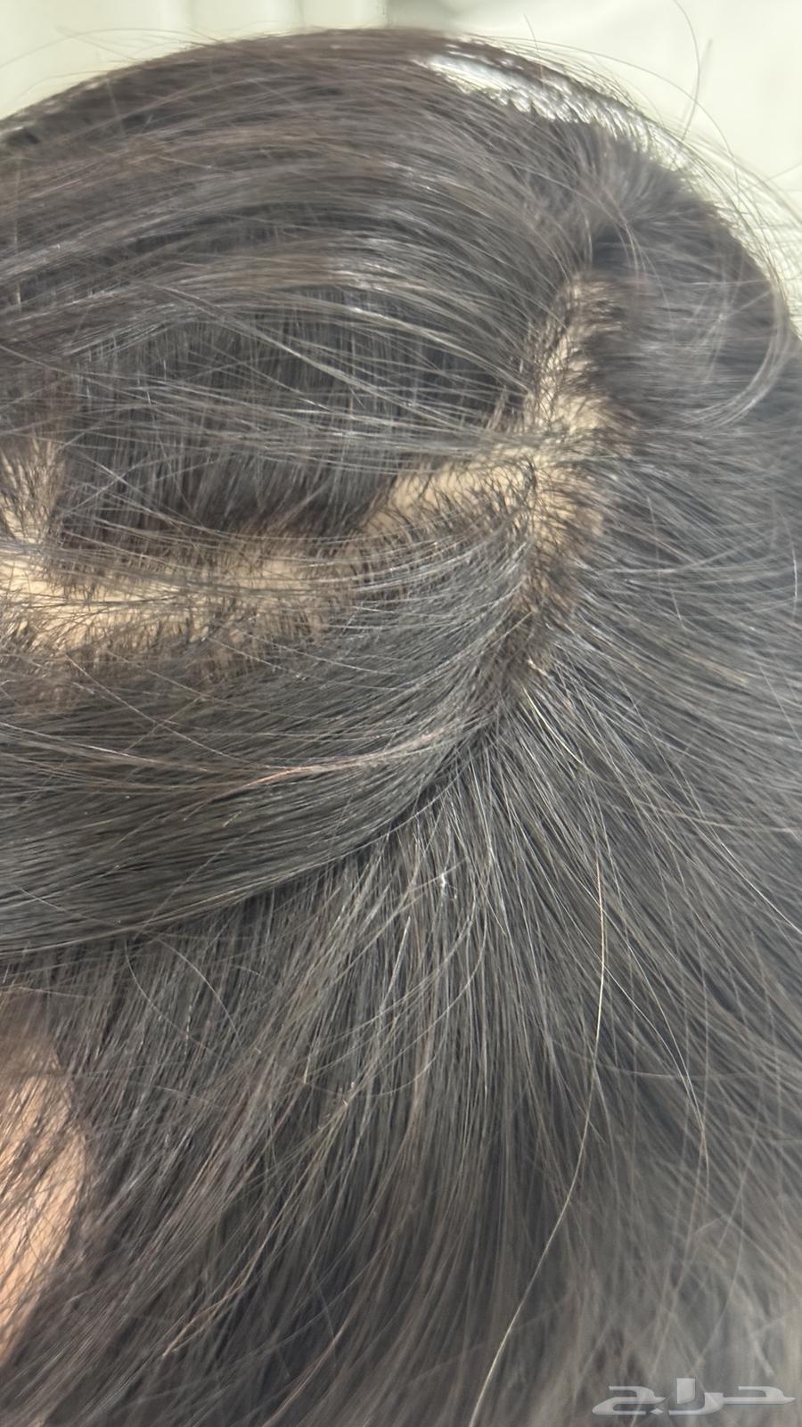 باروكه شعر طبيعي64546985310467111