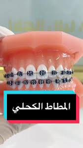 تقويم اسنان زينه عروض اليوم الوطني64575629449089113