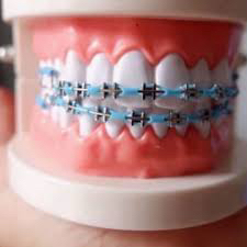 تقويم اسنان زينه عروض اليوم الوطني64575629449089111