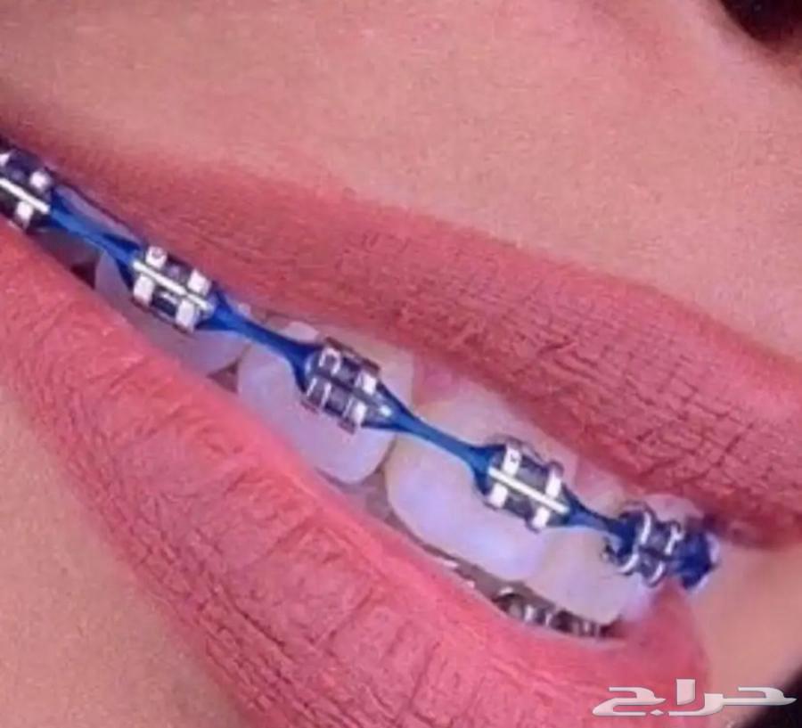 تقويم اسنان زينه عروض اليوم الوطني64575629449089110