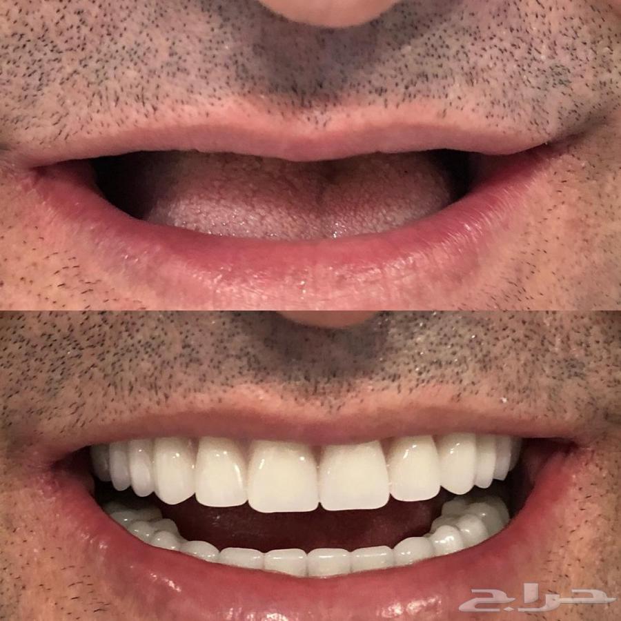 أطقم متحركة كاملة (( بالمجان ))64579773589634110