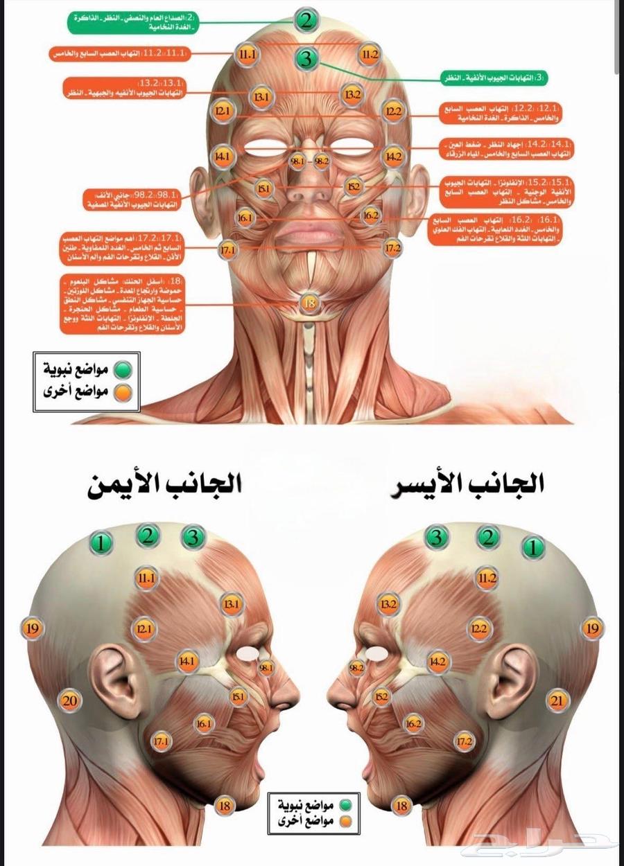 أخصائي حجامة سوداني بالرياض64227053190914112
