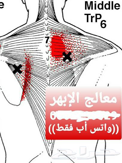 Are you suffering from sciatica or do you know someone who has natural treatment for sciatica and forget the pain64539570738307110