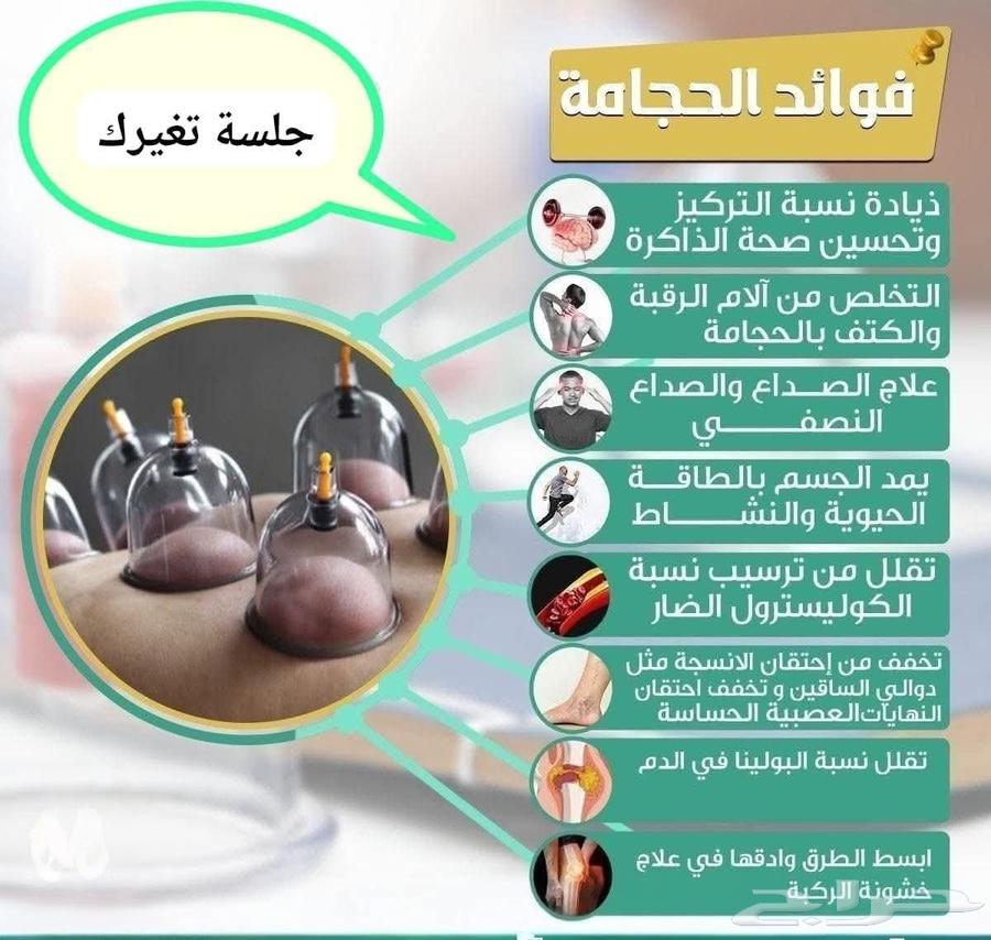 حجامة السنة بالرياض64187262663810110