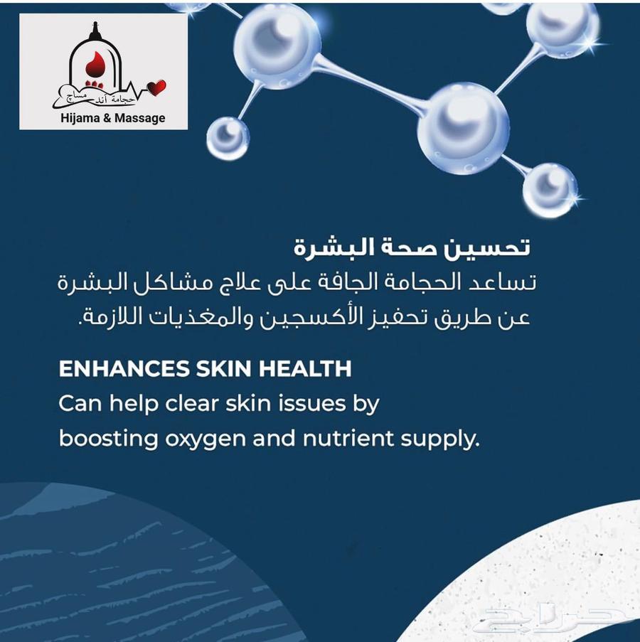 الحجامة النبوية64190478060290110