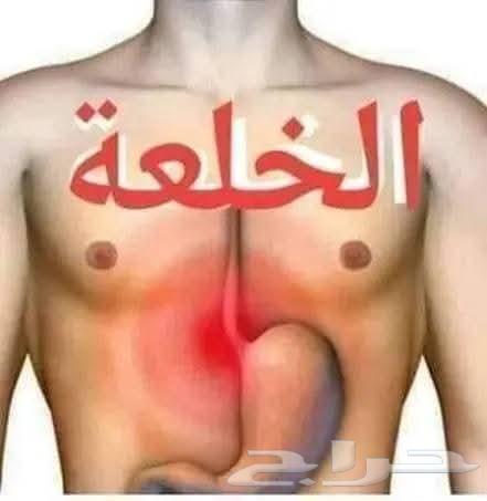 الخلعه وعلاجها64484047217666110