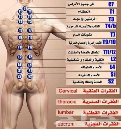 اخصائي حجامة. حجامة منزلية. حجام الرياض.حجامة زيارات منزلية64208360134017110