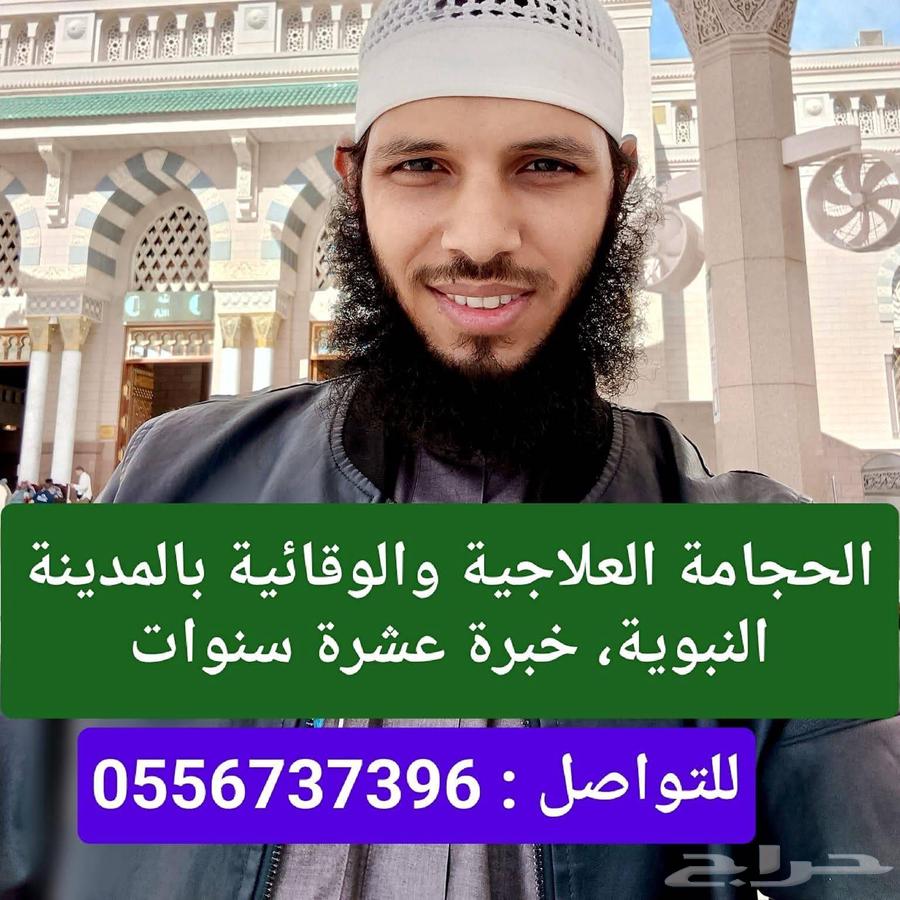 حجامة نارية وهوائية بالمدينة المنورة  خبرة 10 سنوات64249505968769112