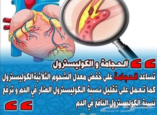 حجامة علاجية ومساج وعلاج الطبيعى أخصائيين زيارات منزلية64459743704449111