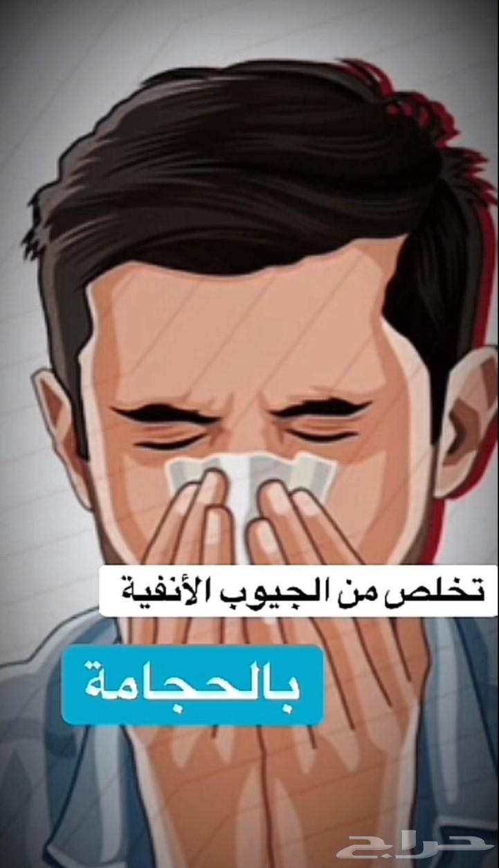 حجامة علاجية ومساج وعلاج الطبيعى أخصائيين زيارات منزلية64459743704449114