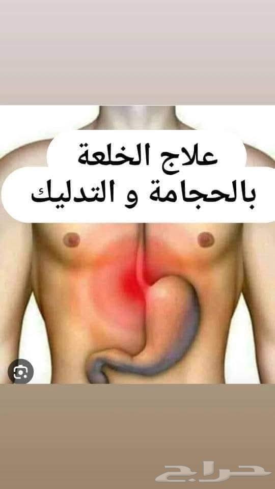 Treating displacement with massage and cupping64459928164353111