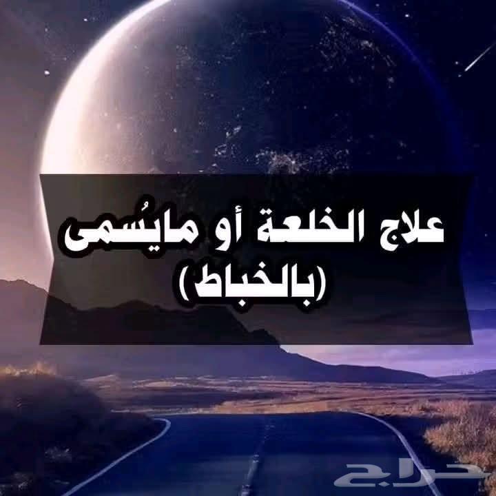 Treating displacement with massage and cupping64459928164353110