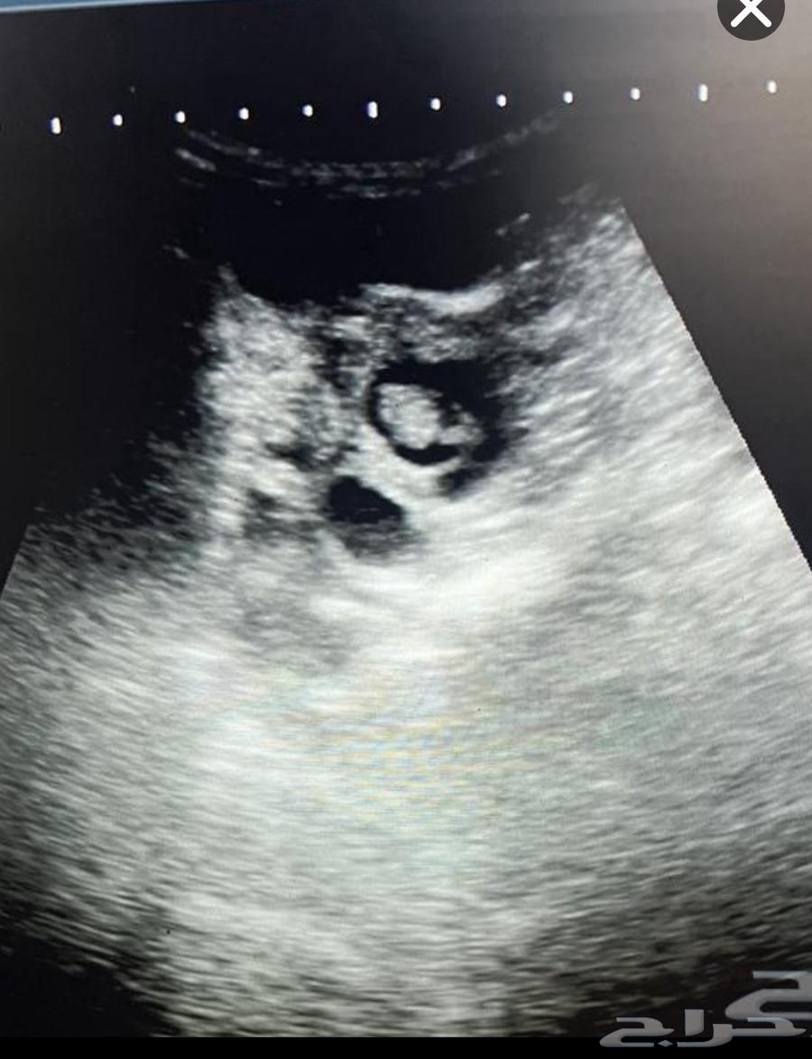 دكتور كشف سونار وتحليل مالطيه64525052677378110