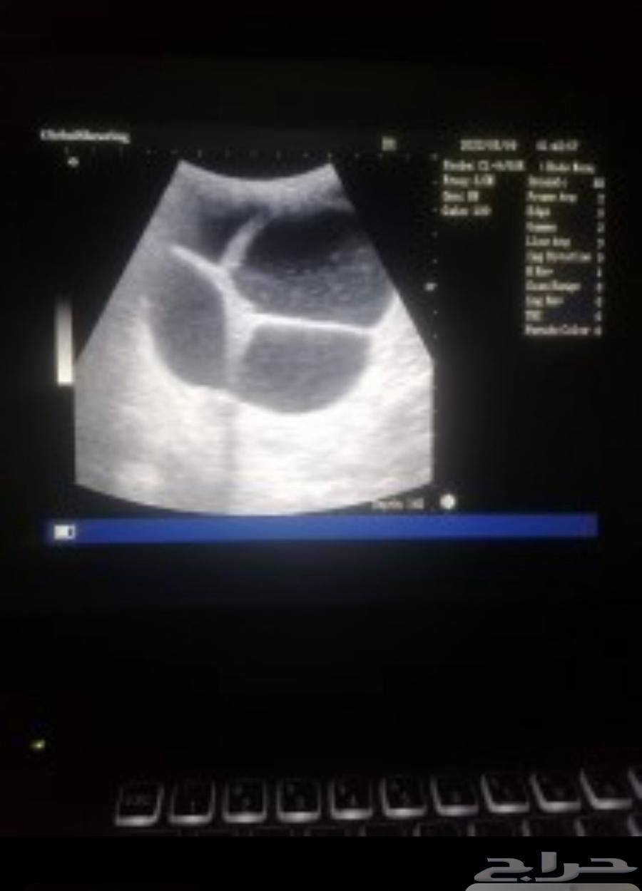 Sheep Sonar Detection64545556157698111