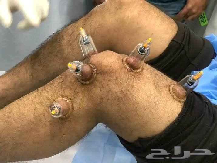 خدمات تمريضيه ومساج علاجي وعلاج طبيعي64613496189953110