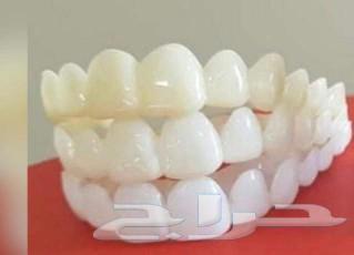 Hollywood snap-on smile made of veneer material63194328470018111