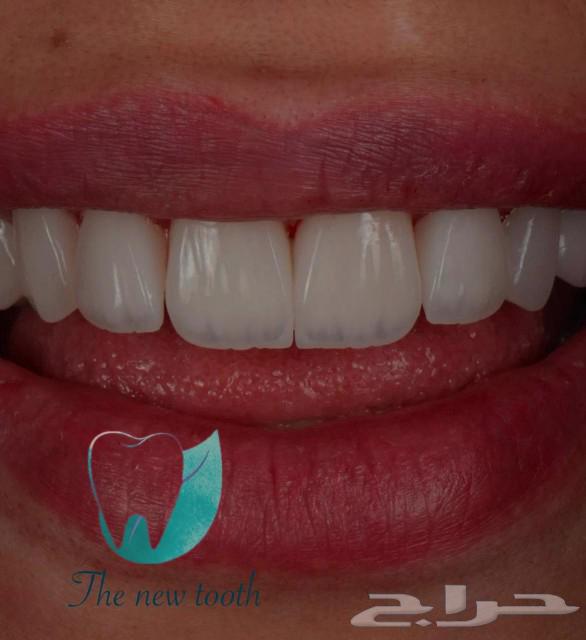 ابتسامه هوليود63189838727171114